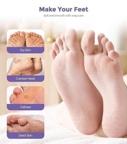 SeoulSkin Exfoliating Foot Mask for Men & Women (1 Pair)
